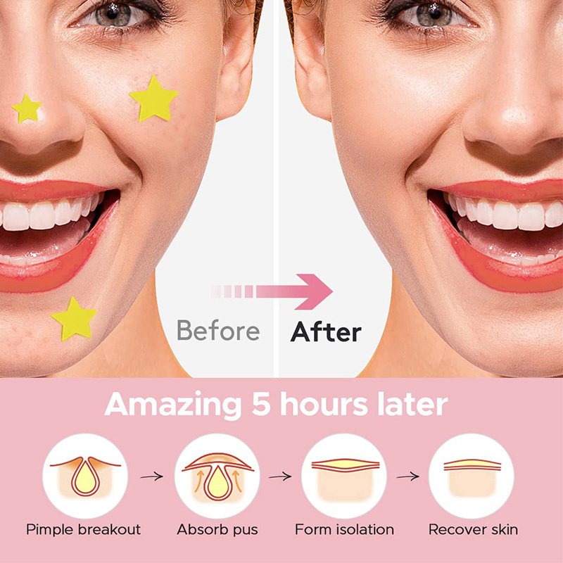 600 sztuk/zestaw Plasterki na  – Makeup And Beauty recenzja i cena